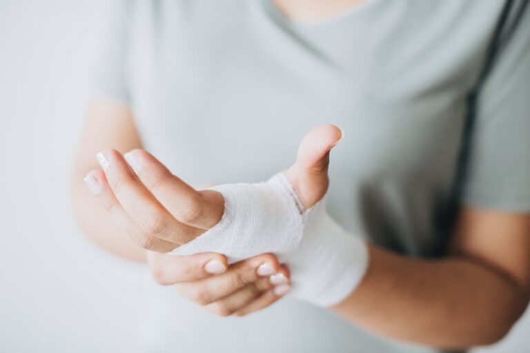 Investigating an Employee Faking Injury From the Workplace